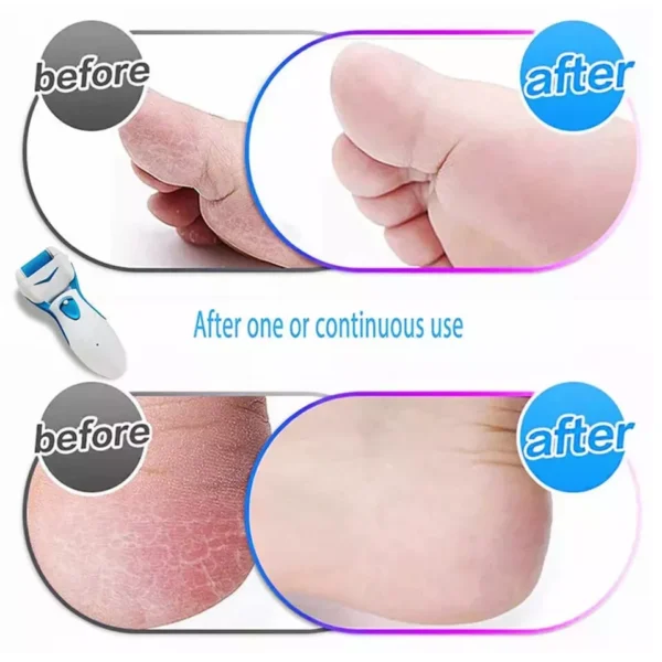 Electric Foot Pedicure Roller File Feet Hard Dead Skin Remover Callus Battery - Image 2